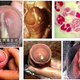 Illustration for article titled Jual Obat Penis Sakit Nyeri Dan Keluar Nanahem/em